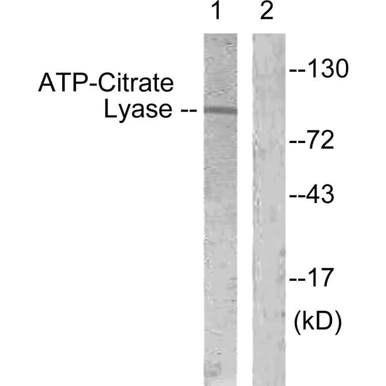 Western Blot - Anti-ATP-Citrate Lyase Antibody (B0618) - Antibodies.com