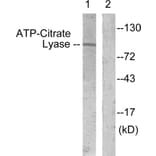Western Blot - Anti-ATP-Citrate Lyase Antibody (B0618) - Antibodies.com