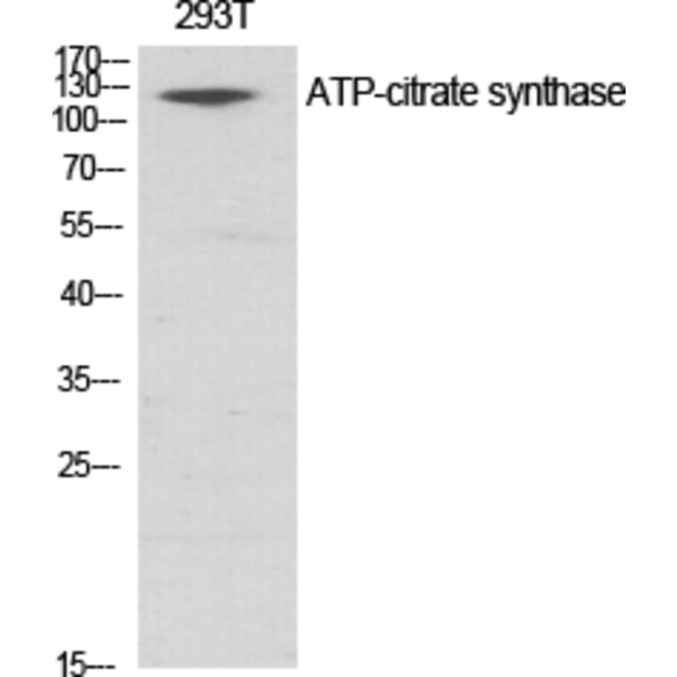 Western Blot - Anti-ATP-Citrate Lyase Antibody (B0618) - Antibodies.com