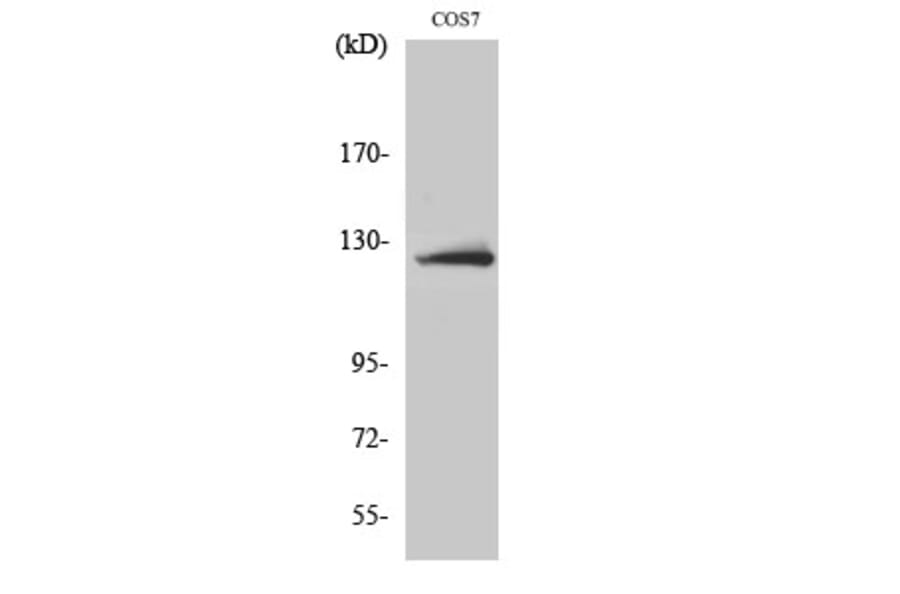 Western Blot - Anti-ATP-Citrate Lyase Antibody (B0618) - Antibodies.com