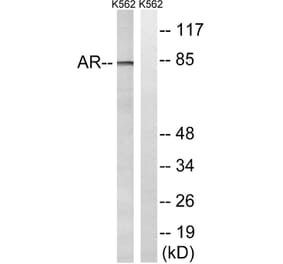 Western Blot - Anti-Androgen Receptor Antibody (B8204) - Antibodies.com