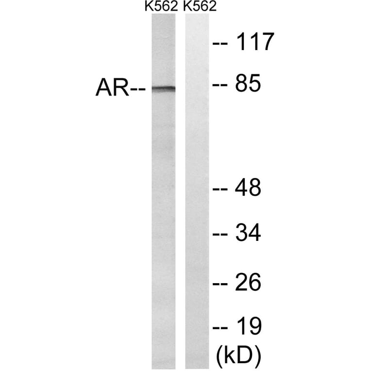Western Blot - Anti-Androgen Receptor Antibody (B8204) - Antibodies.com