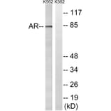 Western Blot - Anti-Androgen Receptor Antibody (B8204) - Antibodies.com