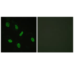 Immunofluorescence - Anti-Androgen Receptor Antibody (B0767) - Antibodies.com