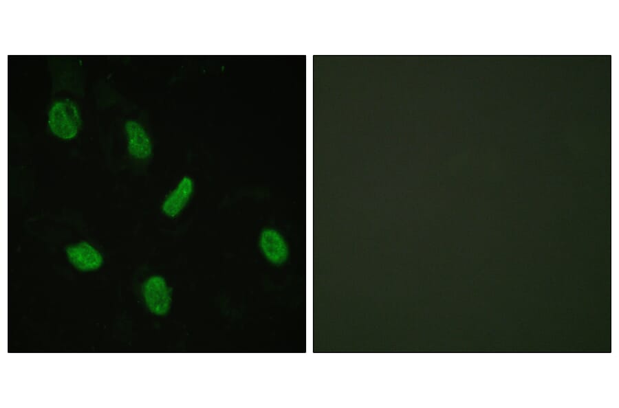 Immunofluorescence - Anti-Androgen Receptor Antibody (B0767) - Antibodies.com