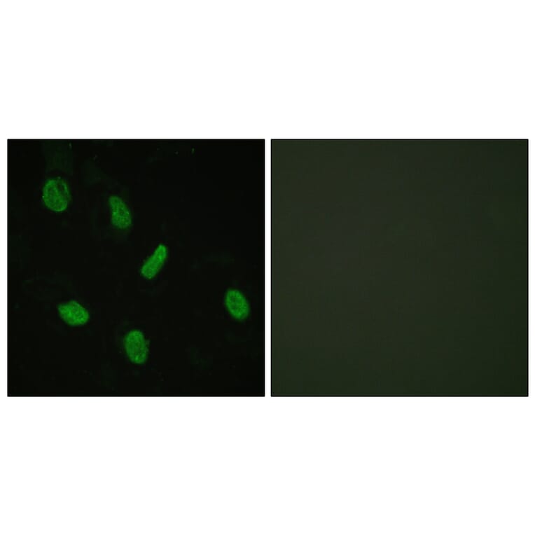 Immunofluorescence - Anti-Androgen Receptor Antibody (B0767) - Antibodies.com