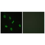 Immunofluorescence - Anti-Androgen Receptor Antibody (B0767) - Antibodies.com