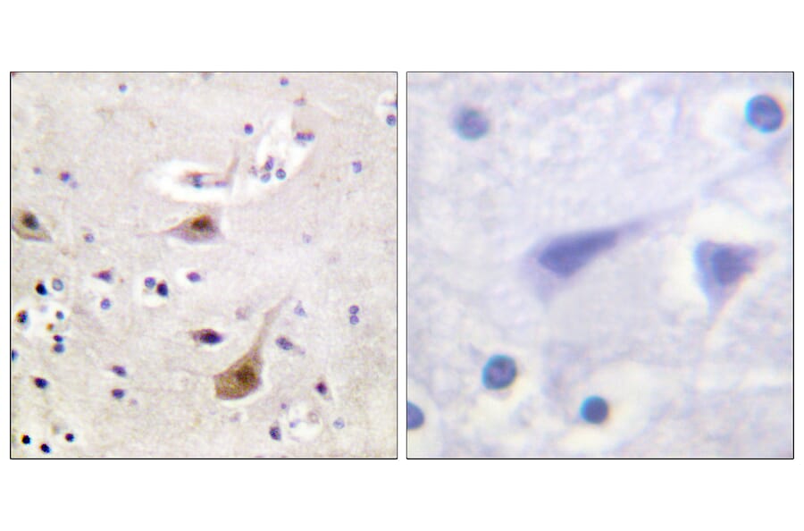 Immunohistochemistry - Anti-Androgen Receptor Antibody (B0767) - Antibodies.com