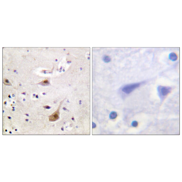 Immunohistochemistry - Anti-Androgen Receptor Antibody (B0767) - Antibodies.com