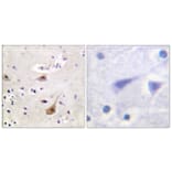 Immunohistochemistry - Anti-Androgen Receptor Antibody (B0767) - Antibodies.com