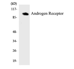 Western Blot - Anti-Androgen Receptor Antibody (R12-2485) - Antibodies.com