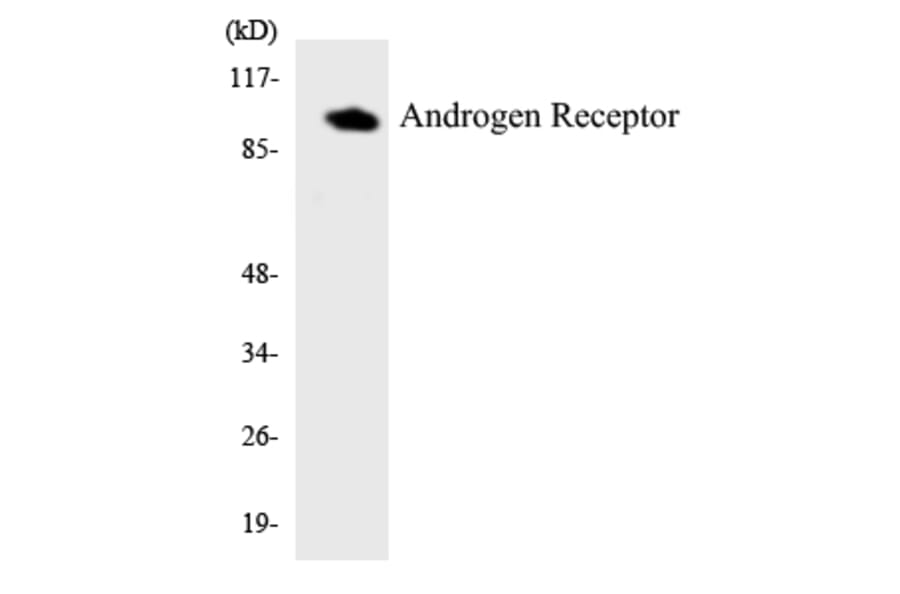Western Blot - Anti-Androgen Receptor Antibody (R12-2485) - Antibodies.com