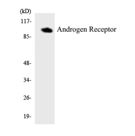 Western Blot - Anti-Androgen Receptor Antibody (R12-2485) - Antibodies.com
