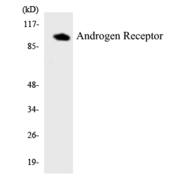 Western Blot - Anti-Androgen Receptor Antibody (R12-2485) - Antibodies.com
