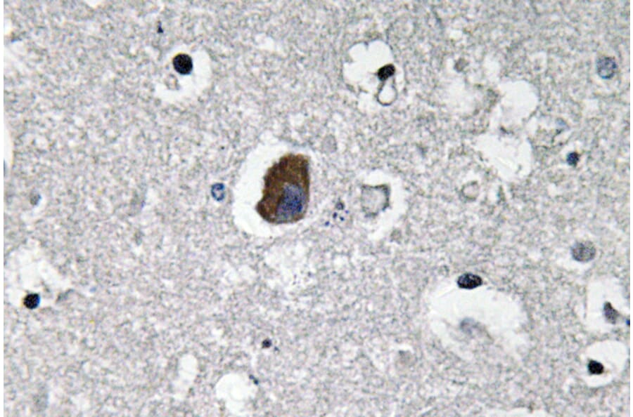 Immunohistochemistry - Anti-P-glycoprotein 1 Antibody (R12-2304) - Antibodies.com