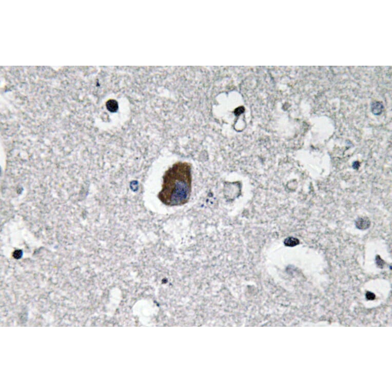 Immunohistochemistry - Anti-P-glycoprotein 1 Antibody (R12-2304) - Antibodies.com