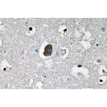 Immunohistochemistry - Anti-P-glycoprotein 1 Antibody (R12-2304) - Antibodies.com