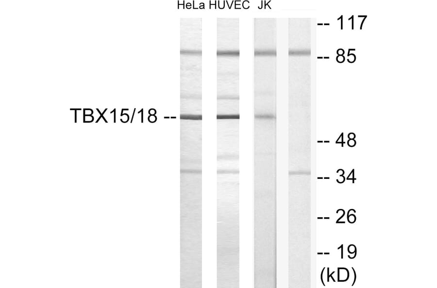 Western Blot - Anti-TBX15 + TBX18 Antibody (C10245) - Antibodies.com