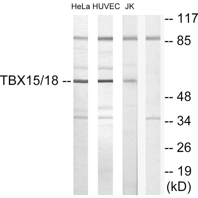 Western Blot - Anti-TBX15 + TBX18 Antibody (C10245) - Antibodies.com