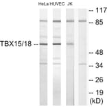 Western Blot - Anti-TBX15 + TBX18 Antibody (C10245) - Antibodies.com
