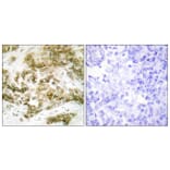 Immunohistochemistry - Anti-TBX15 + TBX18 Antibody (C10245) - Antibodies.com