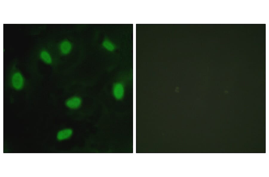 Immunofluorescence - Anti-TBX15 + TBX18 Antibody (C10245) - Antibodies.com