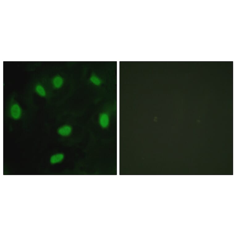 Immunofluorescence - Anti-TBX15 + TBX18 Antibody (C10245) - Antibodies.com