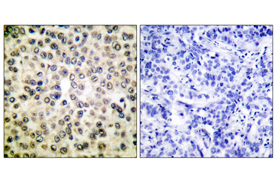 Immunohistochemistry - Anti-NF-kappaB p65 Antibody (D0038) - Antibodies.com