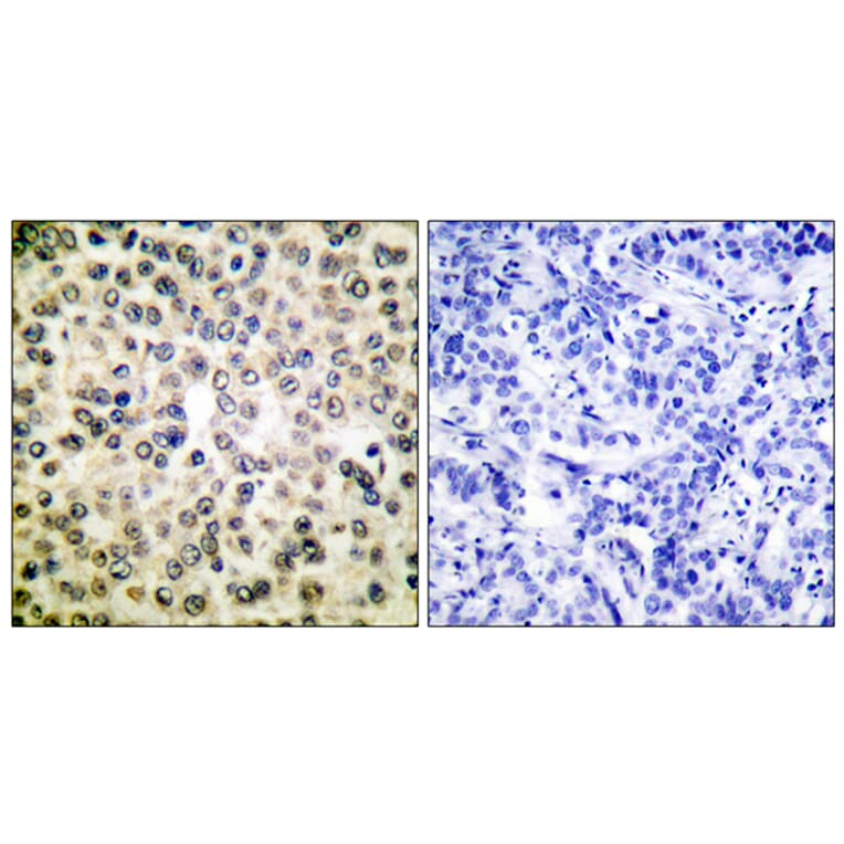 Immunohistochemistry - Anti-NF-kappaB p65 Antibody (D0038) - Antibodies.com