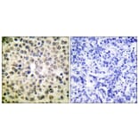 Immunohistochemistry - Anti-NF-kappaB p65 Antibody (D0038) - Antibodies.com