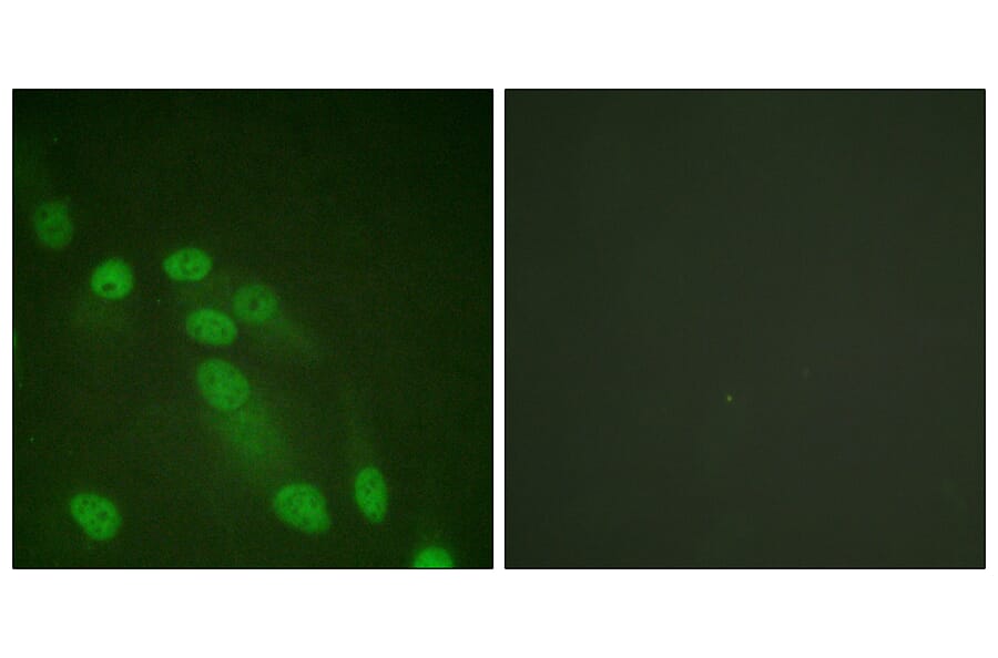 Immunofluorescence - Anti-NF-kappaB p65 Antibody (D0038) - Antibodies.com