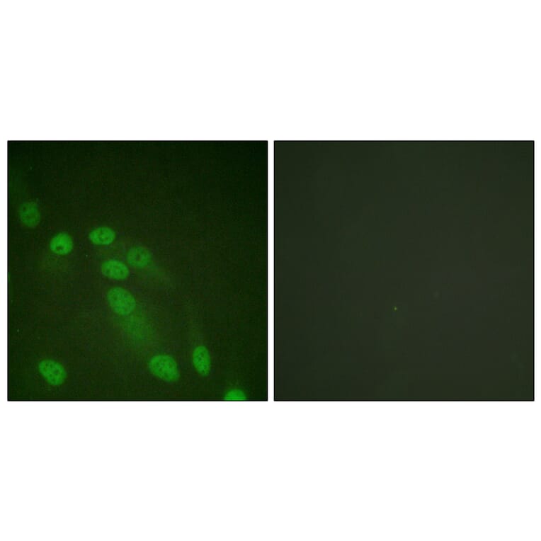 Immunofluorescence - Anti-NF-kappaB p65 Antibody (D0038) - Antibodies.com
