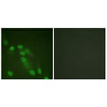 Immunofluorescence - Anti-NF-kappaB p65 Antibody (D0038) - Antibodies.com