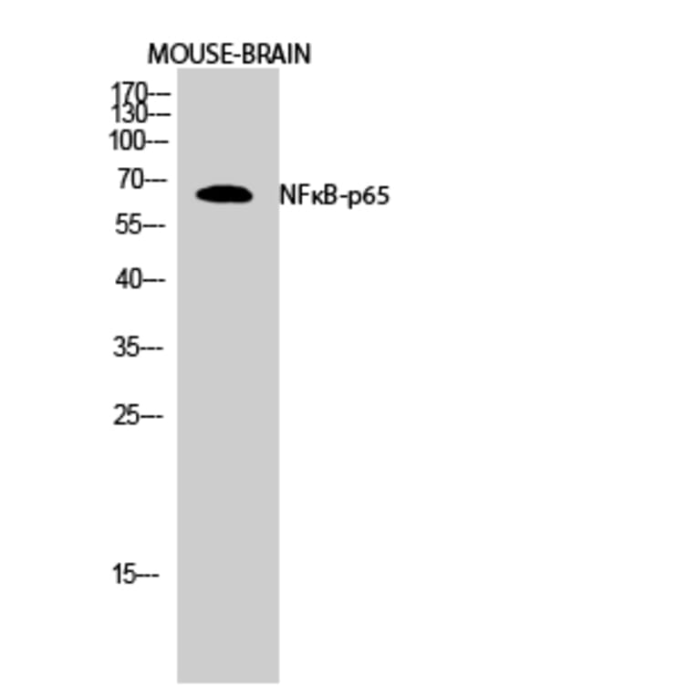 Western Blot - Anti-NF-kappaB p65 Antibody (D0038) - Antibodies.com