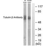 Western Blot - Anti-Tubulin beta Antibody (C0380) - Antibodies.com