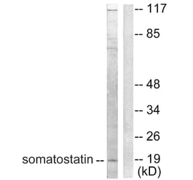 Western Blot - Anti-Somatostatin Antibody (C0328) - Antibodies.com