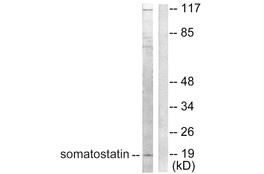 Western Blot - Anti-Somatostatin Antibody (C0328) - Antibodies.com