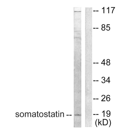 Western Blot - Anti-Somatostatin Antibody (C0328) - Antibodies.com