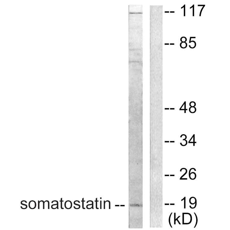 Western Blot - Anti-Somatostatin Antibody (C0328) - Antibodies.com