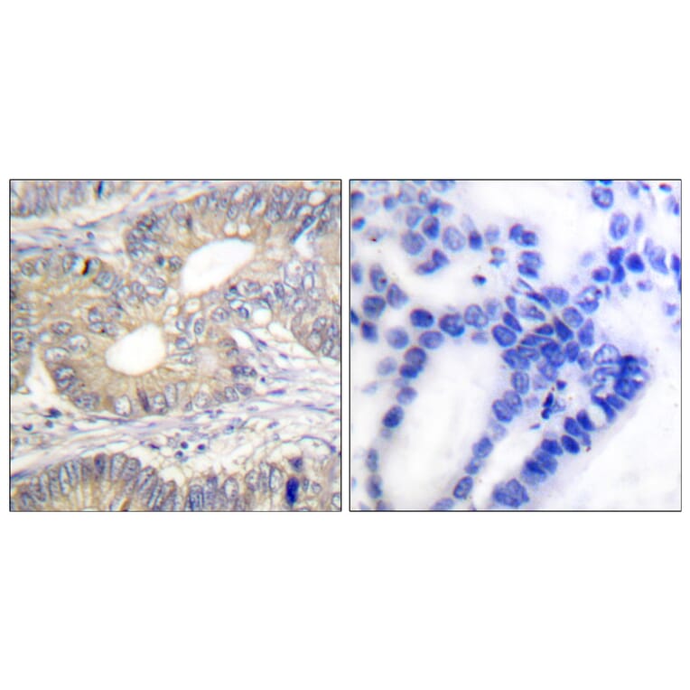 Immunohistochemistry - Anti-Somatostatin Antibody (C0328) - Antibodies.com