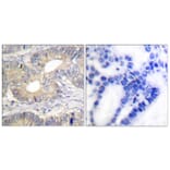 Immunohistochemistry - Anti-Somatostatin Antibody (C0328) - Antibodies.com