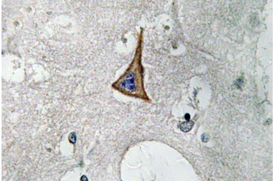 Immunohistochemistry - Anti-Neuropilin-1 Antibody (R12-2258) - Antibodies.com