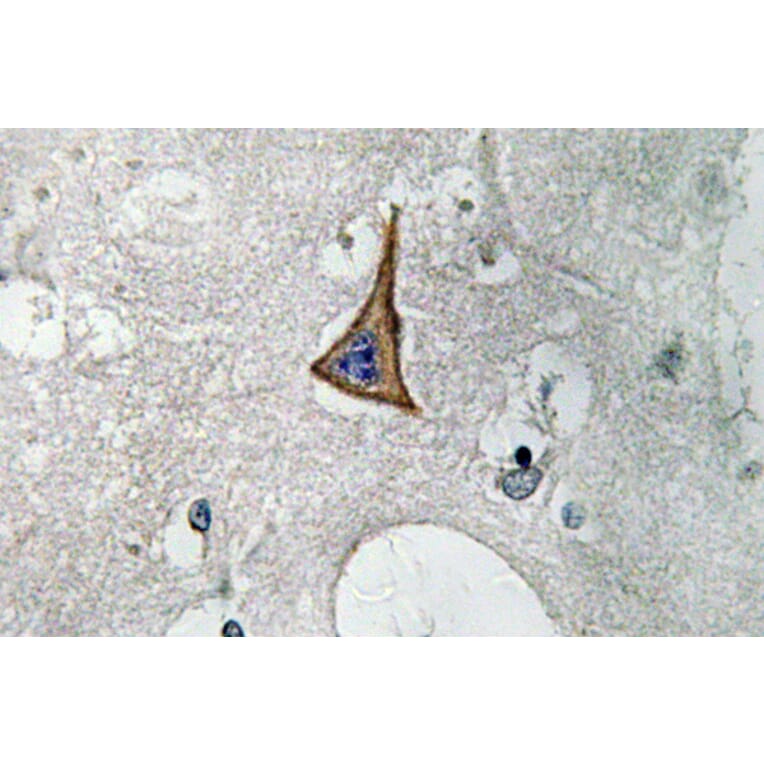 Immunohistochemistry - Anti-Neuropilin-1 Antibody (R12-2258) - Antibodies.com