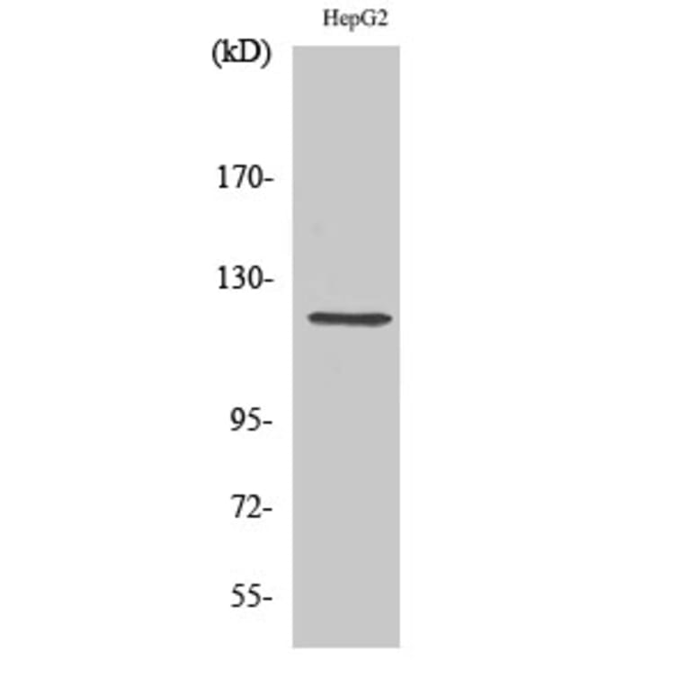Western Blot - Anti-Neuropilin-1 Antibody (R12-2258) - Antibodies.com