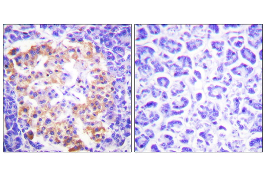 Immunohistochemistry - Anti-Collagen III Antibody (C0156) - Antibodies.com