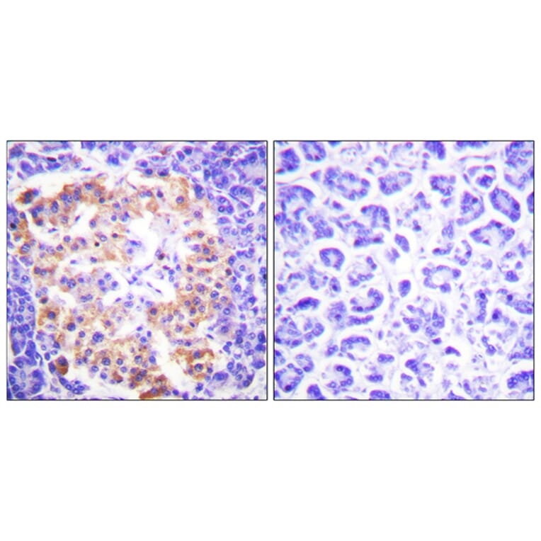 Immunohistochemistry - Anti-Collagen III Antibody (C0156) - Antibodies.com
