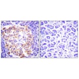 Immunohistochemistry - Anti-Collagen III Antibody (C0156) - Antibodies.com