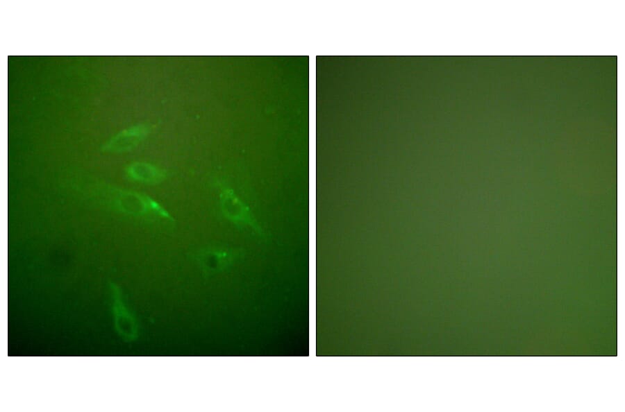 Immunofluorescence - Anti-Collagen III Antibody (C0156) - Antibodies.com