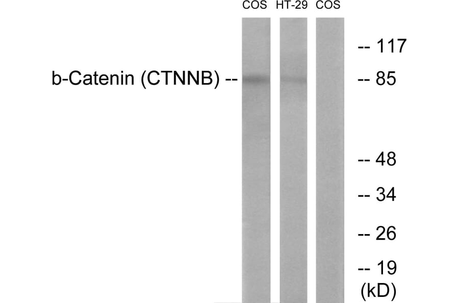 Western Blot - Anti-Catenin-beta Antibody (B7022) - Antibodies.com