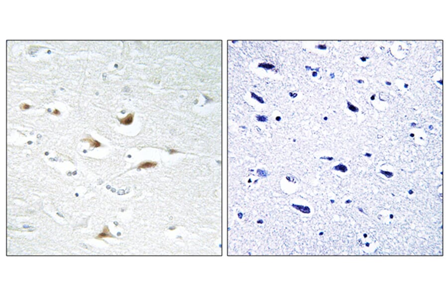 Immunohistochemistry - Anti-Catenin-beta Antibody (B7022) - Antibodies.com